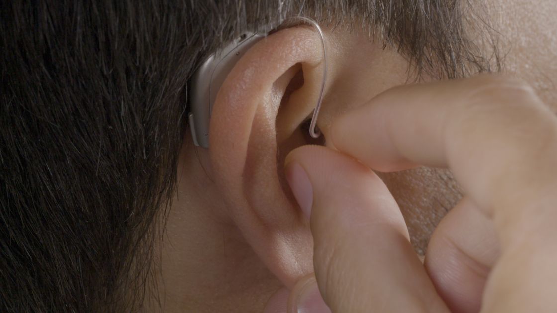 Amplifon hearing aid - Types, prices, benefits